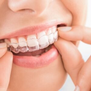 Invisalign can fix your smile